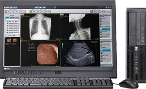 デジタル画像診断システム